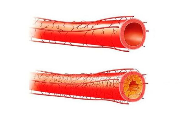 problemi s potencijom zbog krvnih žila